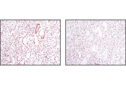  Image 26: Human Exhausted CD8+ T Cell IHC Antibody Sampler Kit