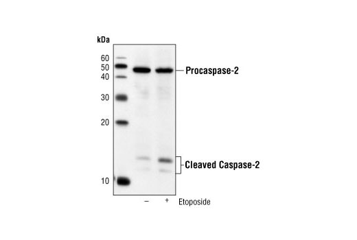  Image 3: Initiator Caspases Antibody Sampler Kit