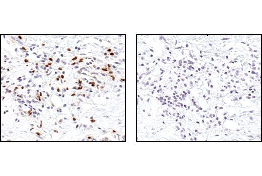 Immunohistochemistry Image 2: PU.1 Antibody