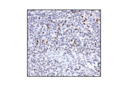 Immunohistochemistry Image 3: PU.1 Antibody