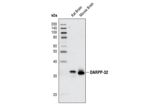 Western Blotting Image 1: DARPP-32 (19A3) Rabbit mAb