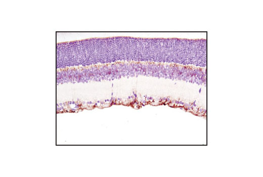 Immunohistochemistry Image 2: DARPP-32 (19A3) Rabbit mAb