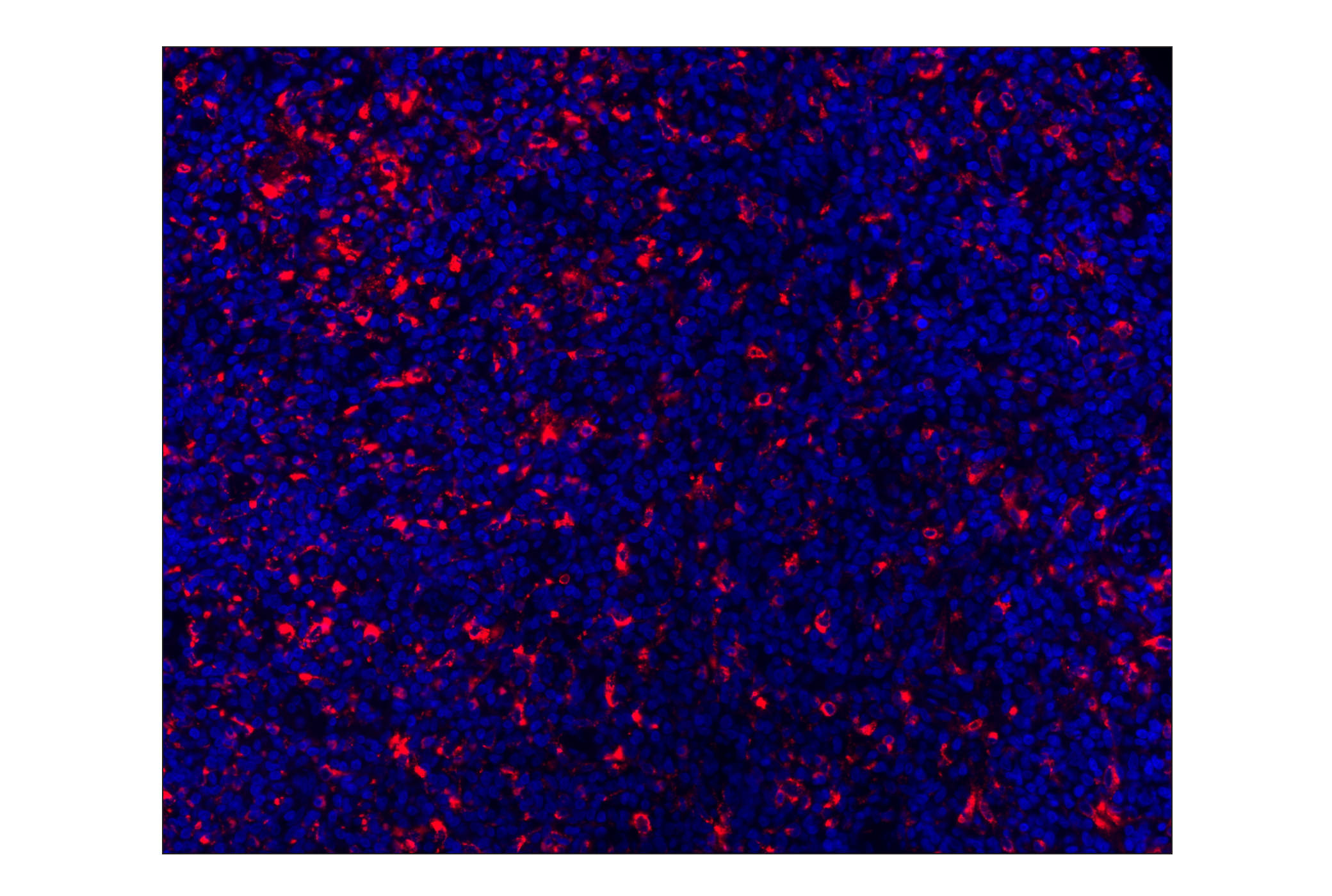 Immunohistochemistry Image 1: CD68 (D4B9C) XP® Rabbit mAb (Alexa Fluor® 555 Conjugate)