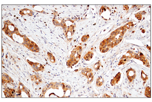  Image 33: Small Cell Lung Cancer Biomarker Antibody Sampler Kit