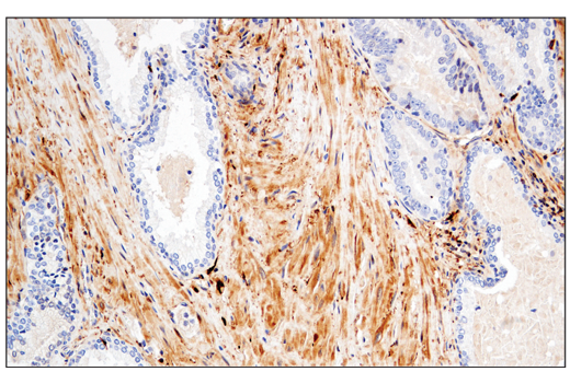  Image 67: Small Cell Lung Cancer Biomarker Antibody Sampler Kit
