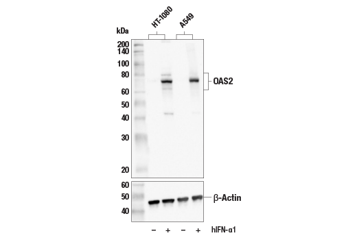 Western Blotting Image 1: OAS2 (E2G4K) Rabbit mAb