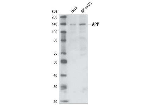  Image 1: Alzheimer's Disease Antibody Sampler Kit