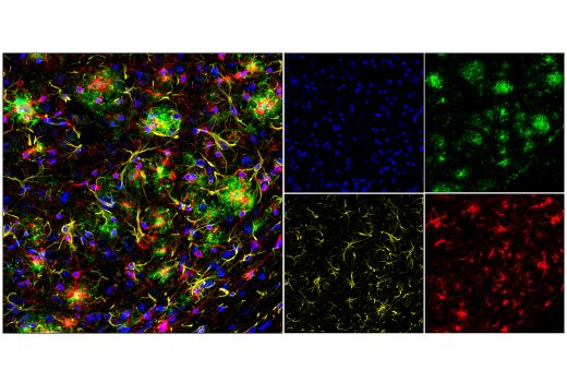  Image 26: Alzheimer's Disease Antibody Sampler Kit