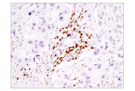 Immunohistochemistry Image 4: CD3ε (D7A6E™) XP® Rabbit mAb (BSA and Azide Free)