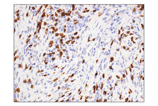 Immunohistochemistry Image 1: CD3ε (D7A6E™) XP® Rabbit mAb (BSA and Azide Free)