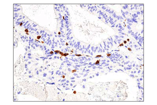 Immunohistochemistry Image 2: CD3ε (D7A6E™) XP® Rabbit mAb (BSA and Azide Free)