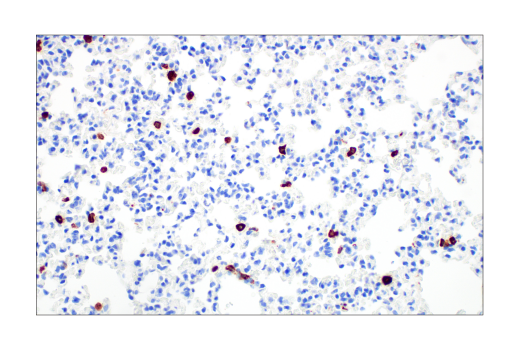 Immunohistochemistry Image 2: CD206/MRC1 (E6T5J) XP® Rabbit mAb