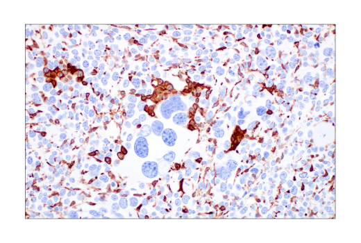  Image 60: Mouse Reactive M1 vs M2 Macrophage IHC Antibody Sampler Kit