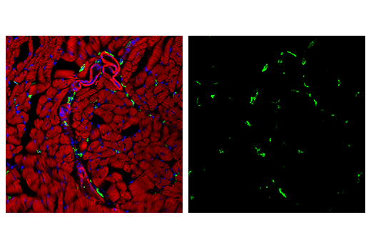  Image 82: Mouse Reactive M1 vs M2 Macrophage IHC Antibody Sampler Kit