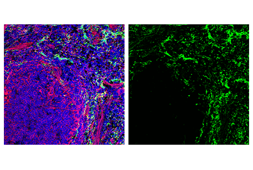  Image 88: Mouse Reactive M1 vs M2 Macrophage IHC Antibody Sampler Kit