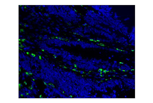 Immunohistochemistry Image 1: CD68 (D4B9C) XP® Rabbit mAb (Alexa Fluor® 488 Conjugate)