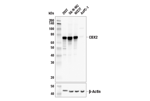 Western Blotting Image 1: CBX2 (E3N6A) Rabbit mAb