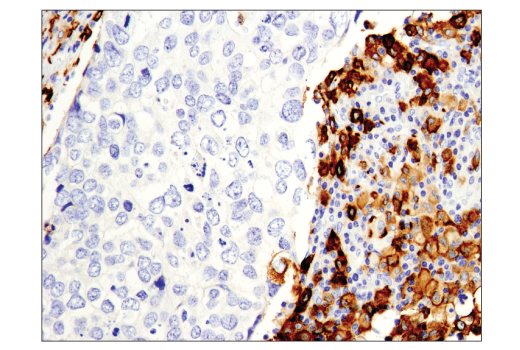 Immunohistochemistry Image 4: CD163 (D6U1J) Rabbit mAb (BSA and Azide Free)