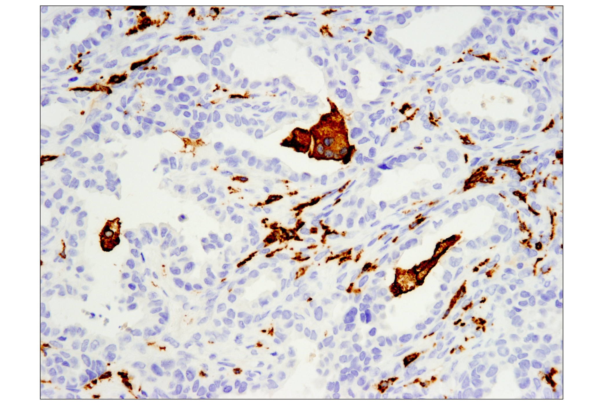 Immunohistochemistry Image 2: CD163 (D6U1J) Rabbit mAb (BSA and Azide Free)