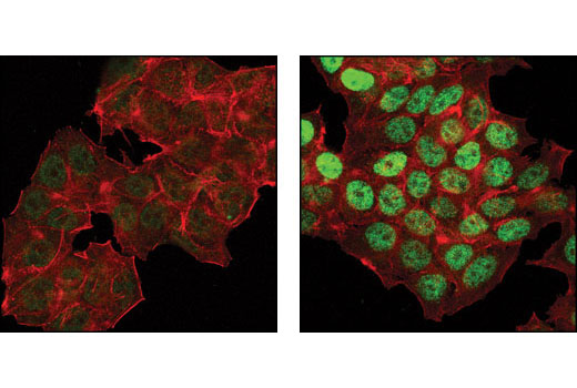 Immunofluorescence Image 1: Phospho-p53 (Ser46) Antibody