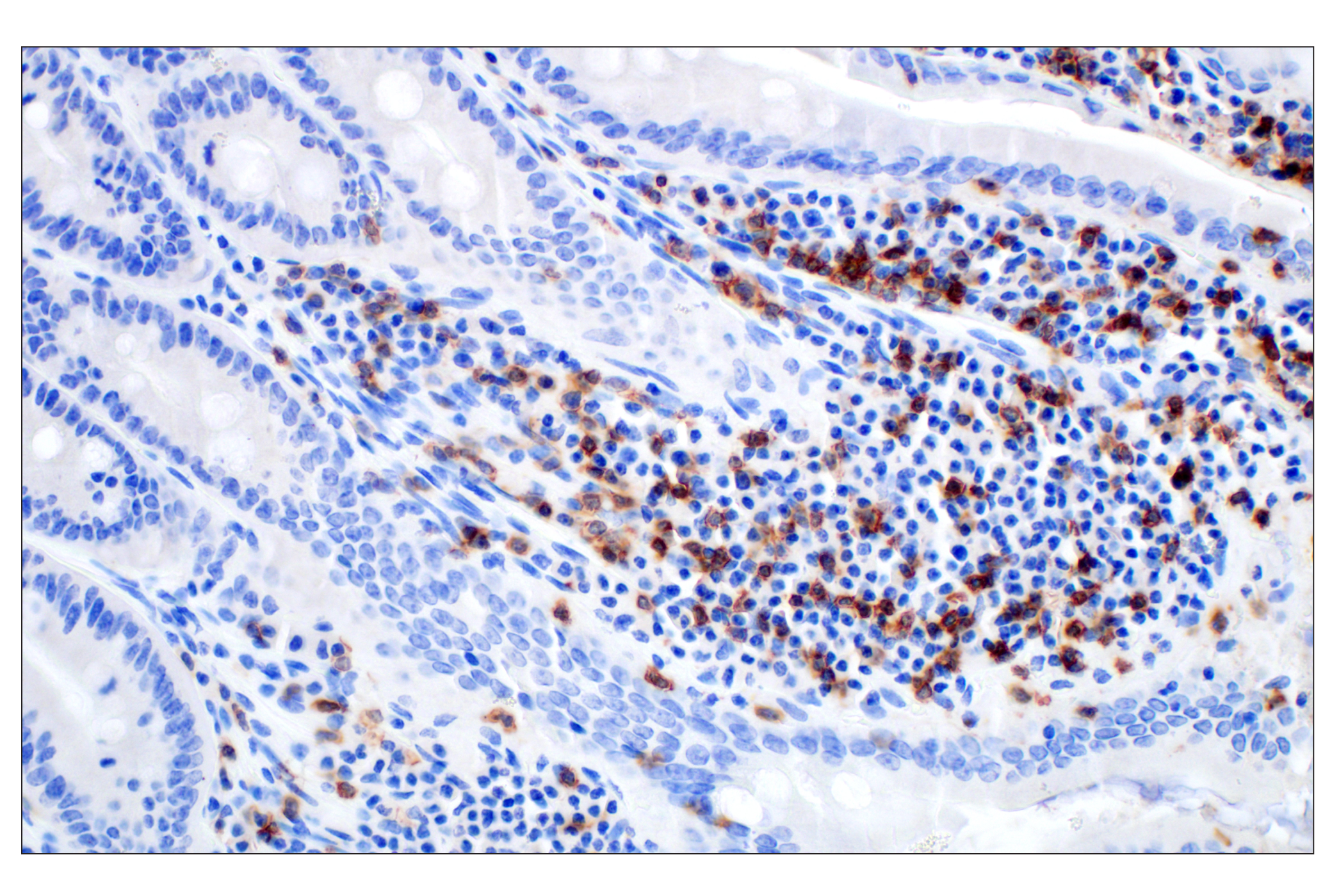  Image 48: Mouse Immune Cell Phenotyping IHC Antibody Sampler Kit