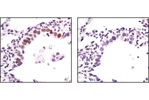  Image 23: p53 Antibody Sampler Kit