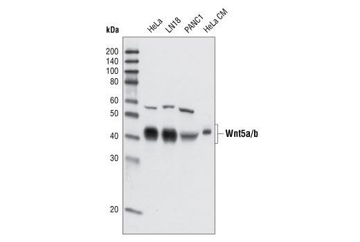 Western Blotting Image 1: Wnt5a/b (C27E8) Rabbit mAb