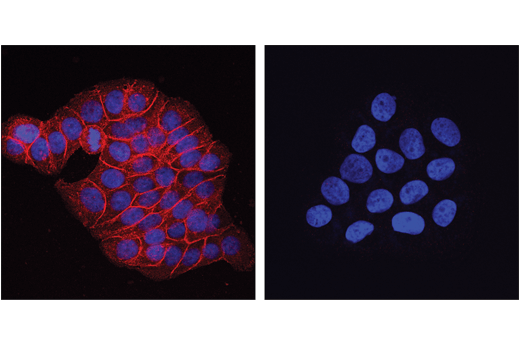 Immunofluorescence Image 1: Met (D1C2) XP® Rabbit mAb (Alexa Fluor® 555 Conjugate)