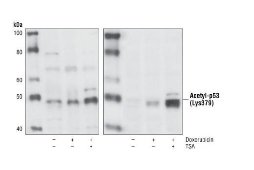  Image 6: p53 Antibody Sampler Kit