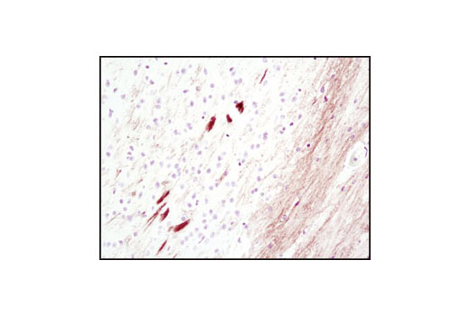 Immunohistochemistry Image 1: DARPP-32 (19A3) Rabbit mAb (BSA and Azide Free)