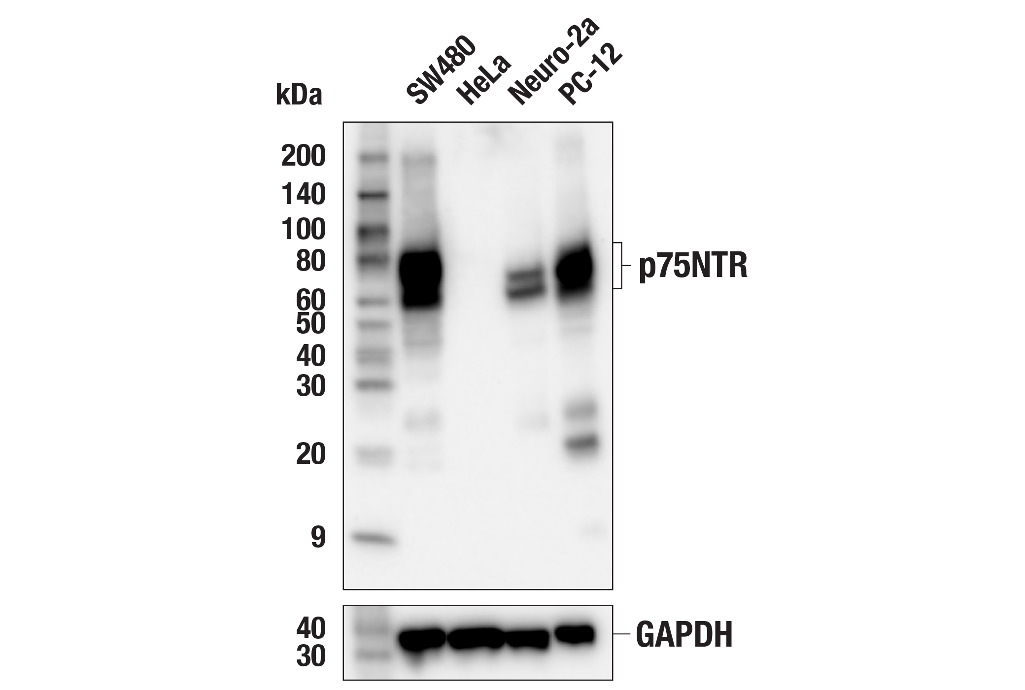 Western Blotting Image 1: p75NTR (F2L9S) Rabbit mAb