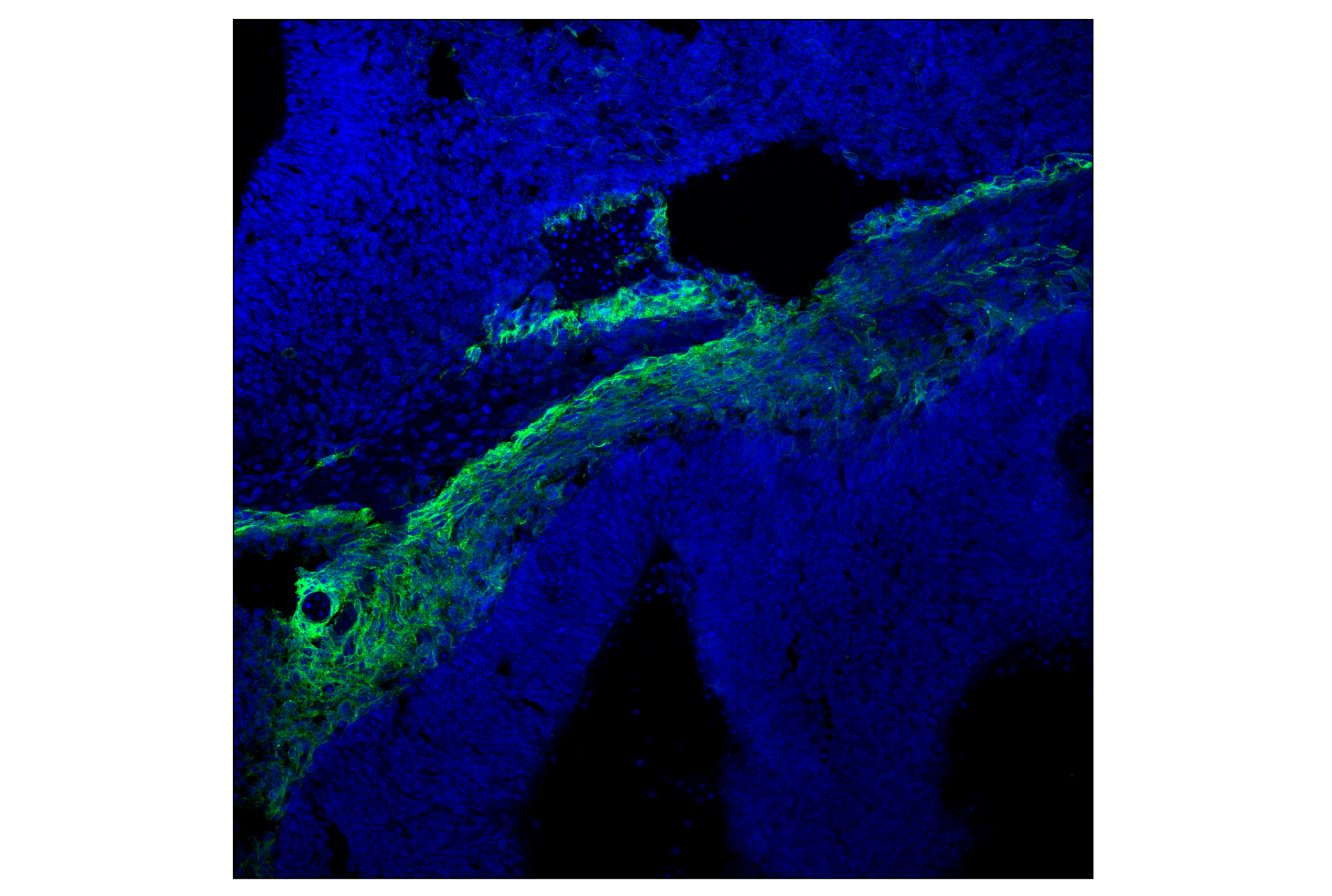 Immunofluorescence Image 2: p75NTR (F2L9S) Rabbit mAb