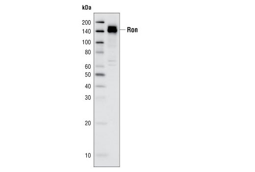 Western Blotting Image 1: Ron (C81H9) Rabbit mAb