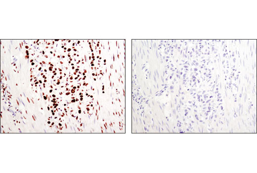 Immunohistochemistry Image 1: Di-Methyl-Histone H3 (Lys36) (C75H12) Rabbit mAb (BSA and Azide Free)