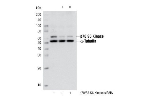 Western Blotting Image 2: p70 S6 Kinase (49D7) Rabbit mAb