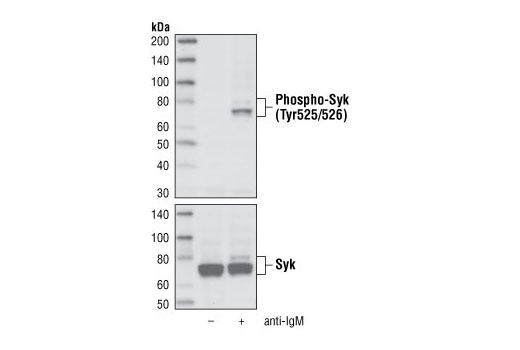  Image 9: TREM2 Signaling Pathways Antibody Sampler Kit