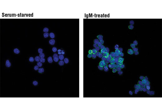 Immunofluorescence Image 1: Phospho-Syk (Tyr525/526) (C87C1) Rabbit mAb (BSA and Azide Free)