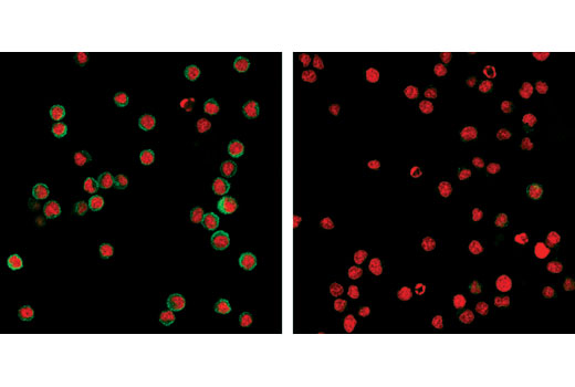  Image 21: TREM2 Signaling Pathways Antibody Sampler Kit