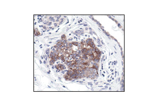  Image 27: Pro-Survival Bcl-2 Family Antibody Sampler Kit II