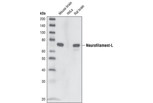  Image 4: Alzheimer's Disease Antibody Sampler Kit