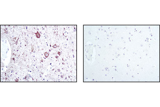  Image 19: Alzheimer's Disease Antibody Sampler Kit