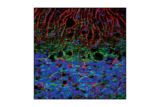  Image 24: Alzheimer's Disease Antibody Sampler Kit