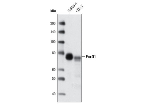 Western Blotting Image 1: FoxO1 (C29H4) Rabbit mAb (BSA and Azide Free)