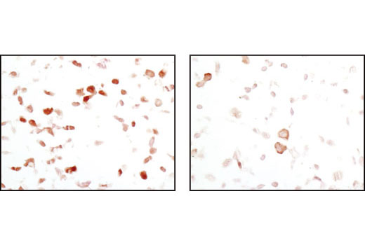 Immunohistochemistry Image 4: FoxO1 (C29H4) Rabbit mAb