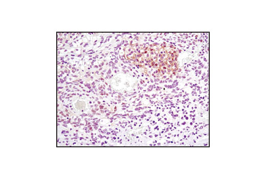 Immunohistochemistry Image 5: FoxO1 (C29H4) Rabbit mAb