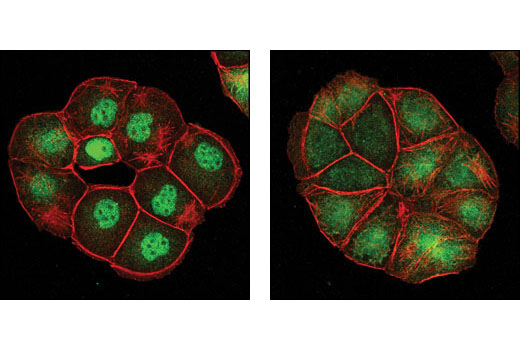 Immunofluorescence Image 1: FoxO1 (C29H4) Rabbit mAb