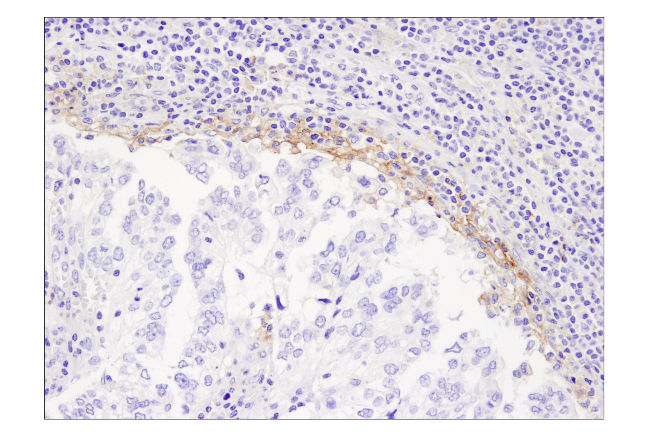 Immunohistochemistry Image 1: PD-L1 (405.9A11) Mouse mAb