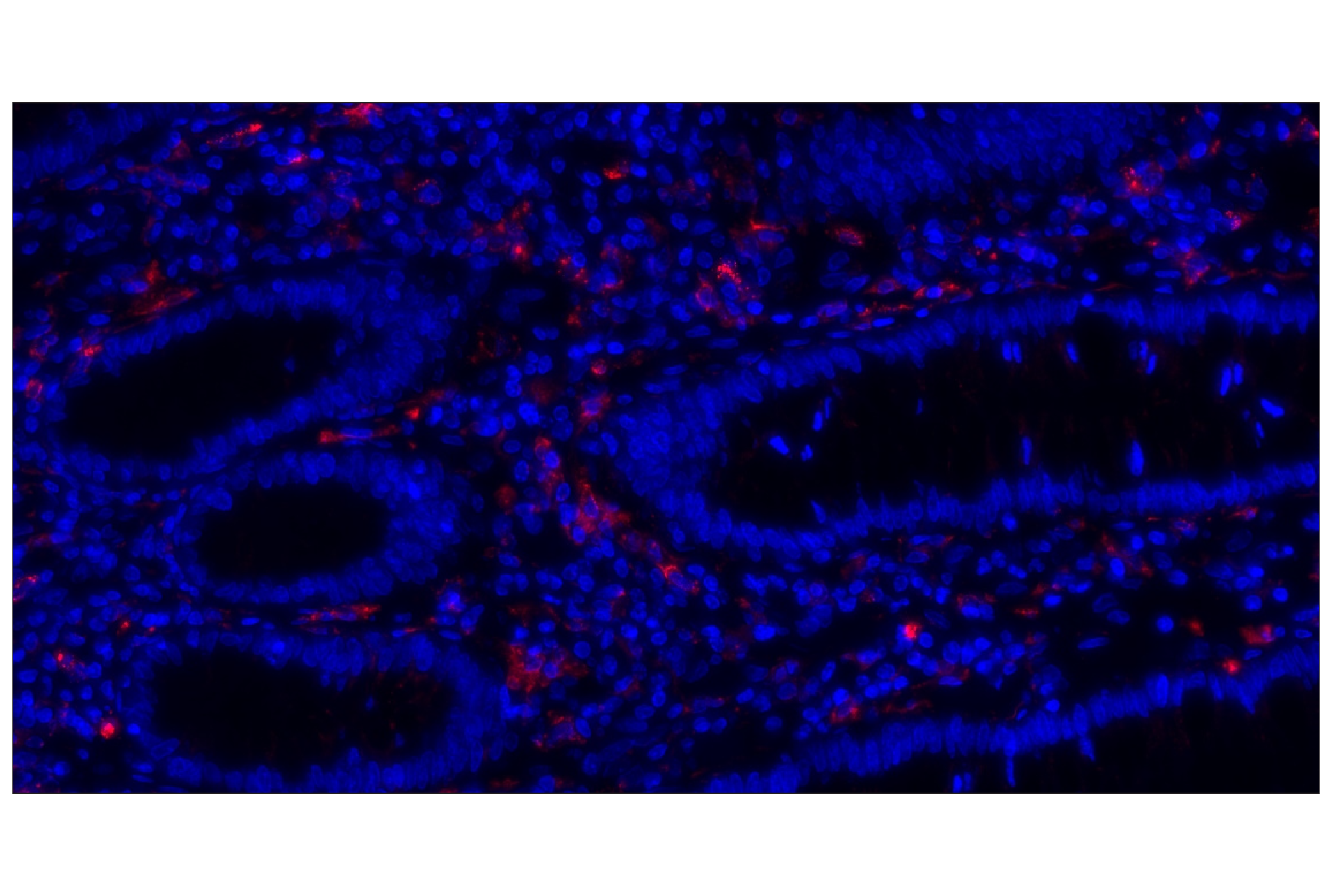 Immunohistochemistry Image 1: HLA-DRA (E9R2Q) XP® Rabbit mAb (Alexa Fluor® 555 Conjugate)