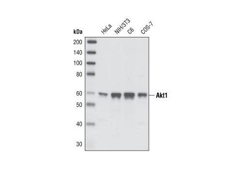  Image 5: Phospho-Akt Isoform Antibody Sampler Kit