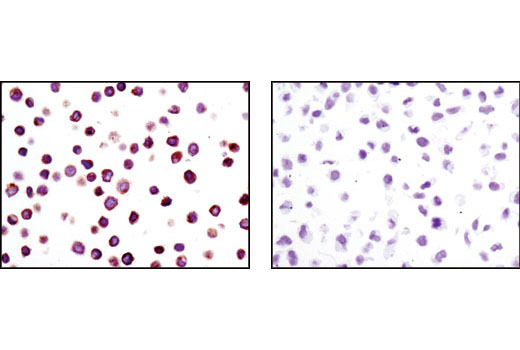 Immunohistochemistry Image 3: Lck (D88) XP® Rabbit mAb